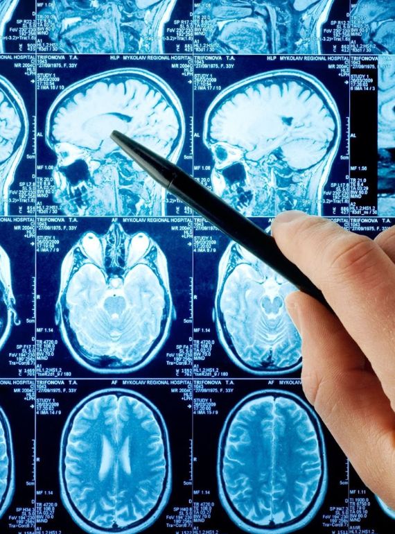 Brain and Spine Injury Specialist